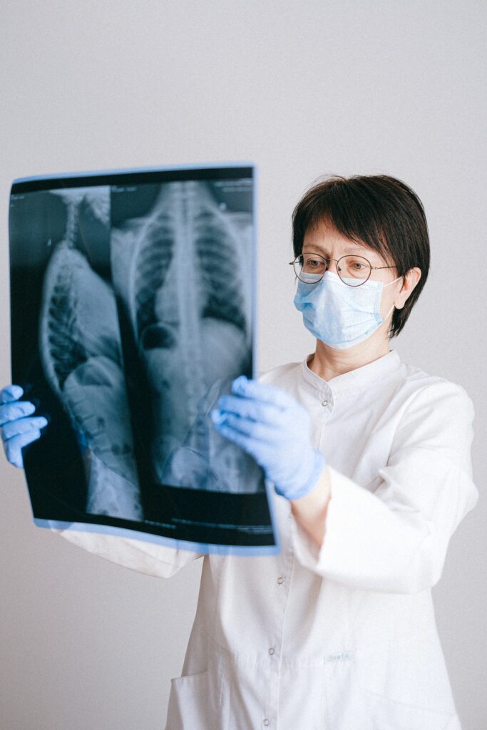 Doctor looking at x-ray of lungs